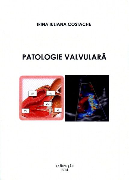 Curs de cardiologie Vol. 1 : Patologie valvulară