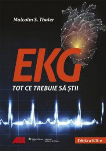 EKG - Tot ce trebuie să știi